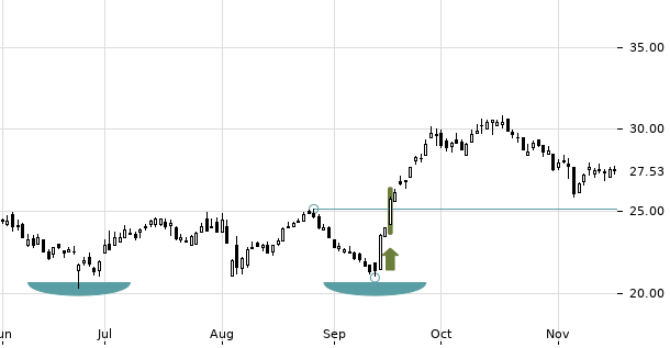 UBS TrendRadar Bild