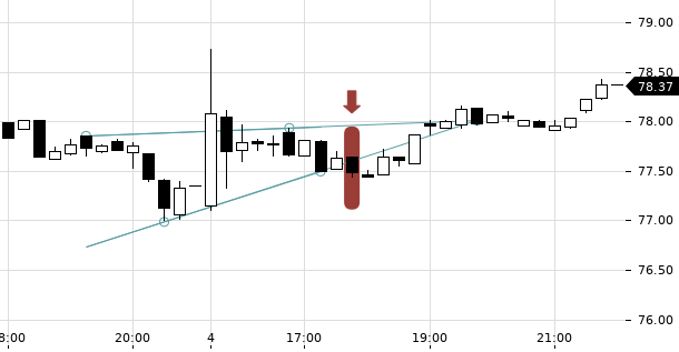 UBS TrendRadar Bild