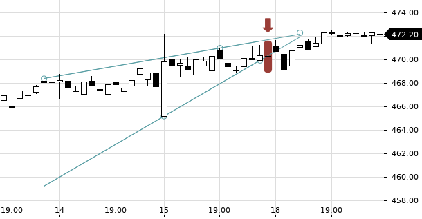 UBS TrendRadar Bild